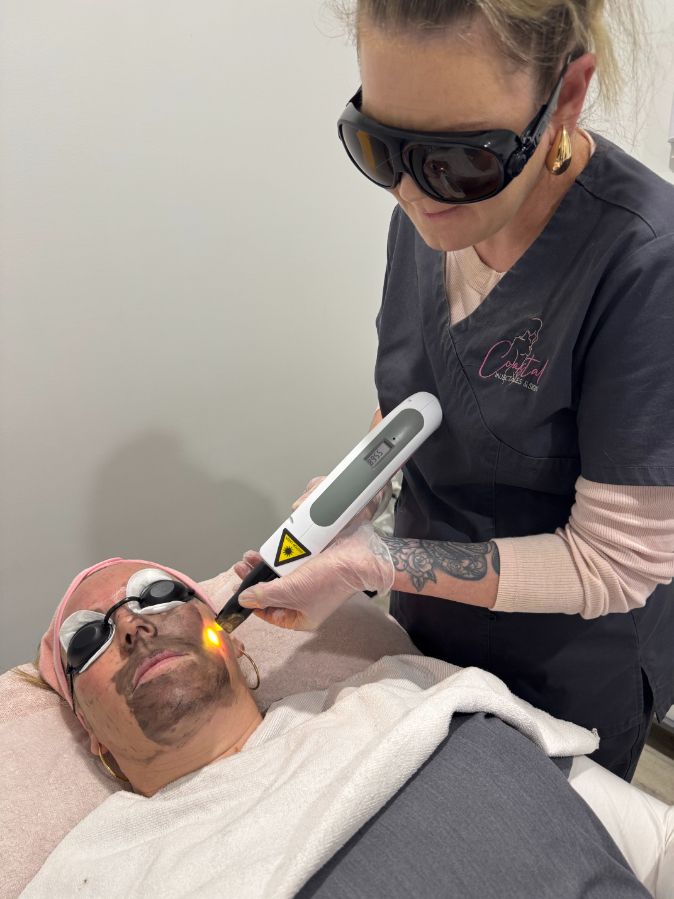 A person who had anti-wrinkle injections in Taree