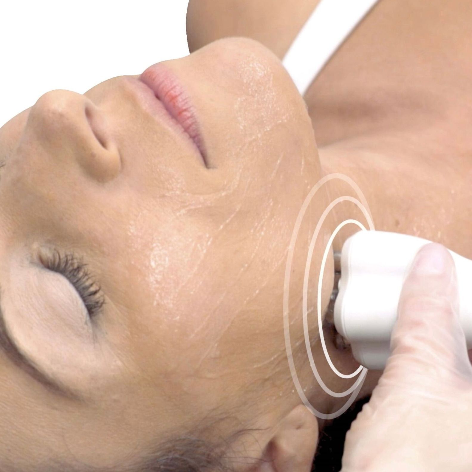 Venus Diamond Polar Treatment
