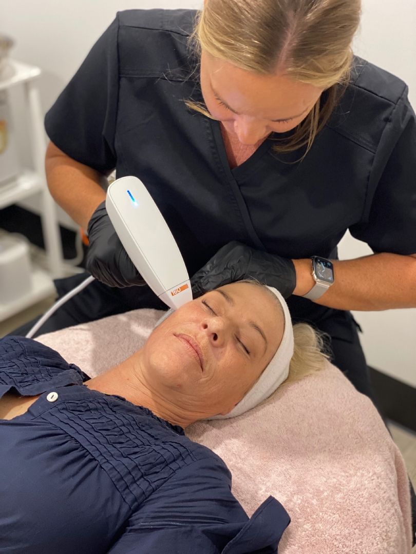 Venus Viva Skin Resurfacing